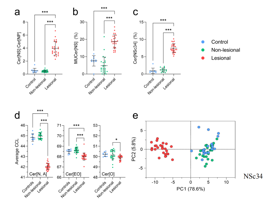 银屑病皮损真相:皮肤角质层神经酰胺图谱全解析